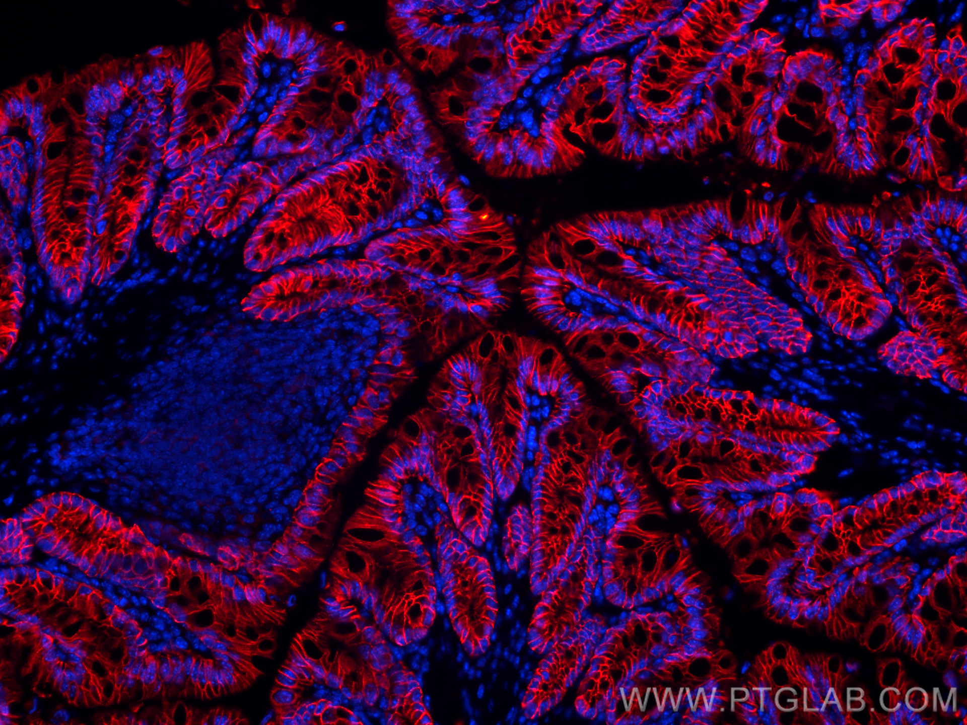 IF Staining of mouse colon using 32189-1-AP