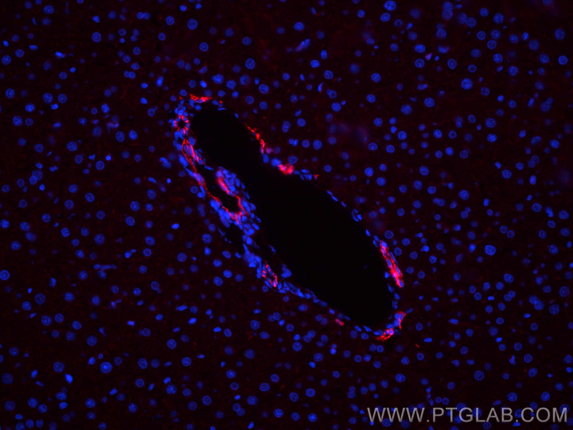 IF Staining of rat liver using 32189-1-AP