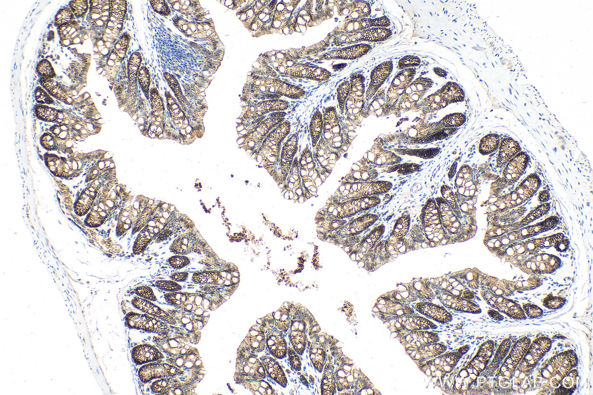 IHC staining of mouse colon using 32189-1-AP