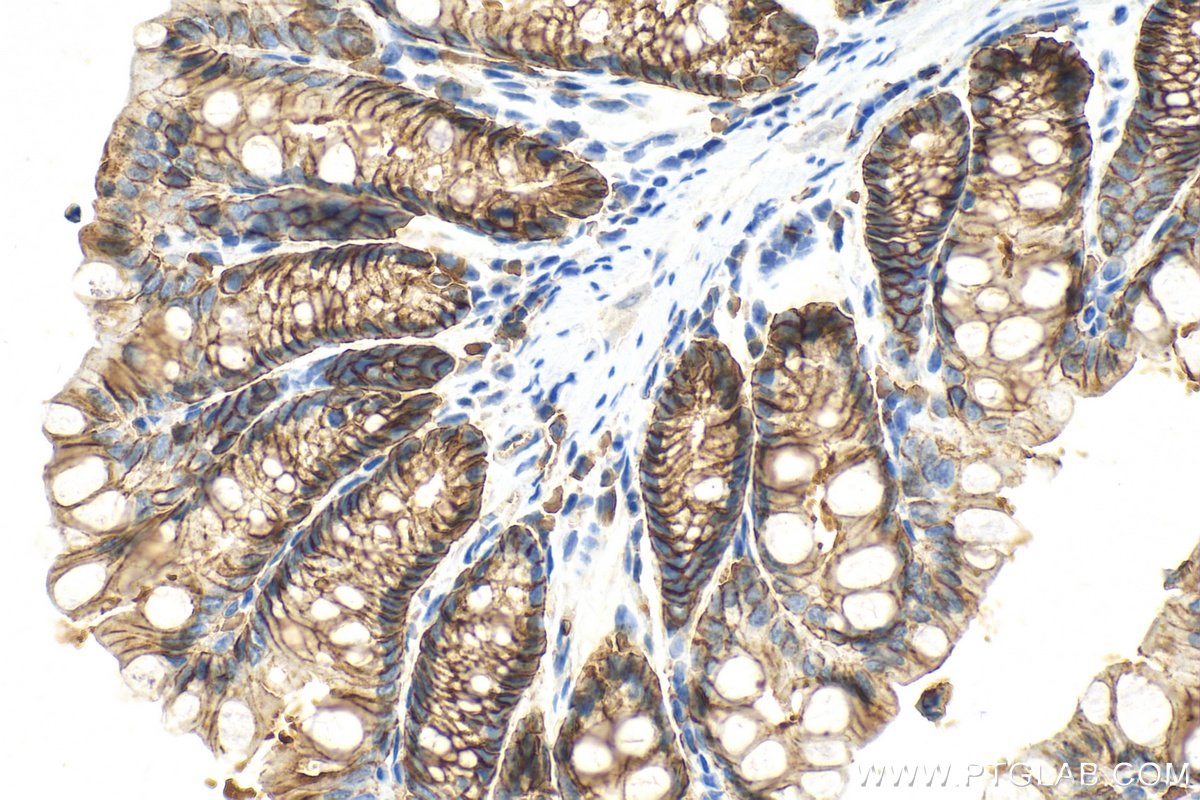 IHC staining of mouse colon using 32189-1-AP