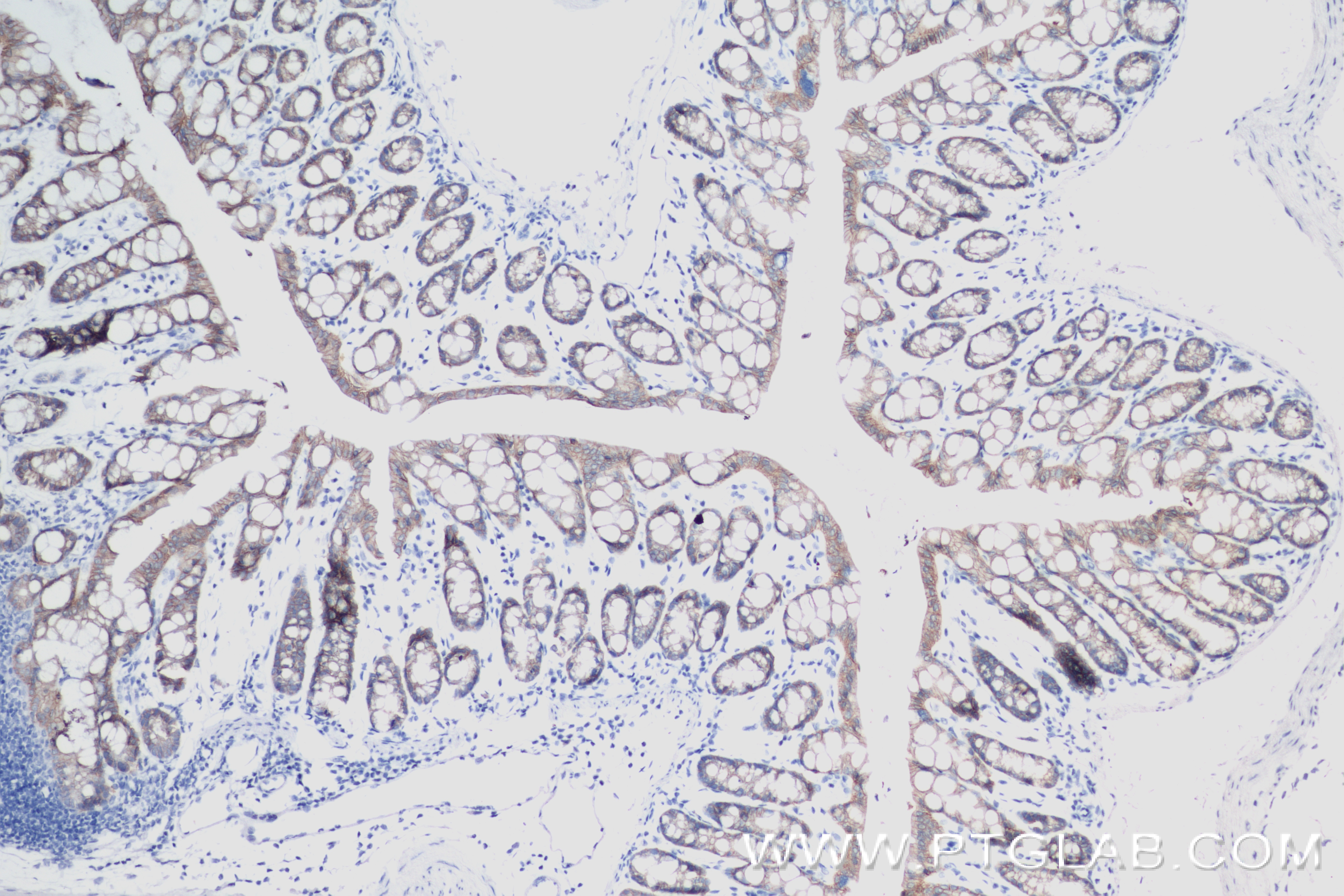 IHC staining of mouse colon using 84490-2-RR