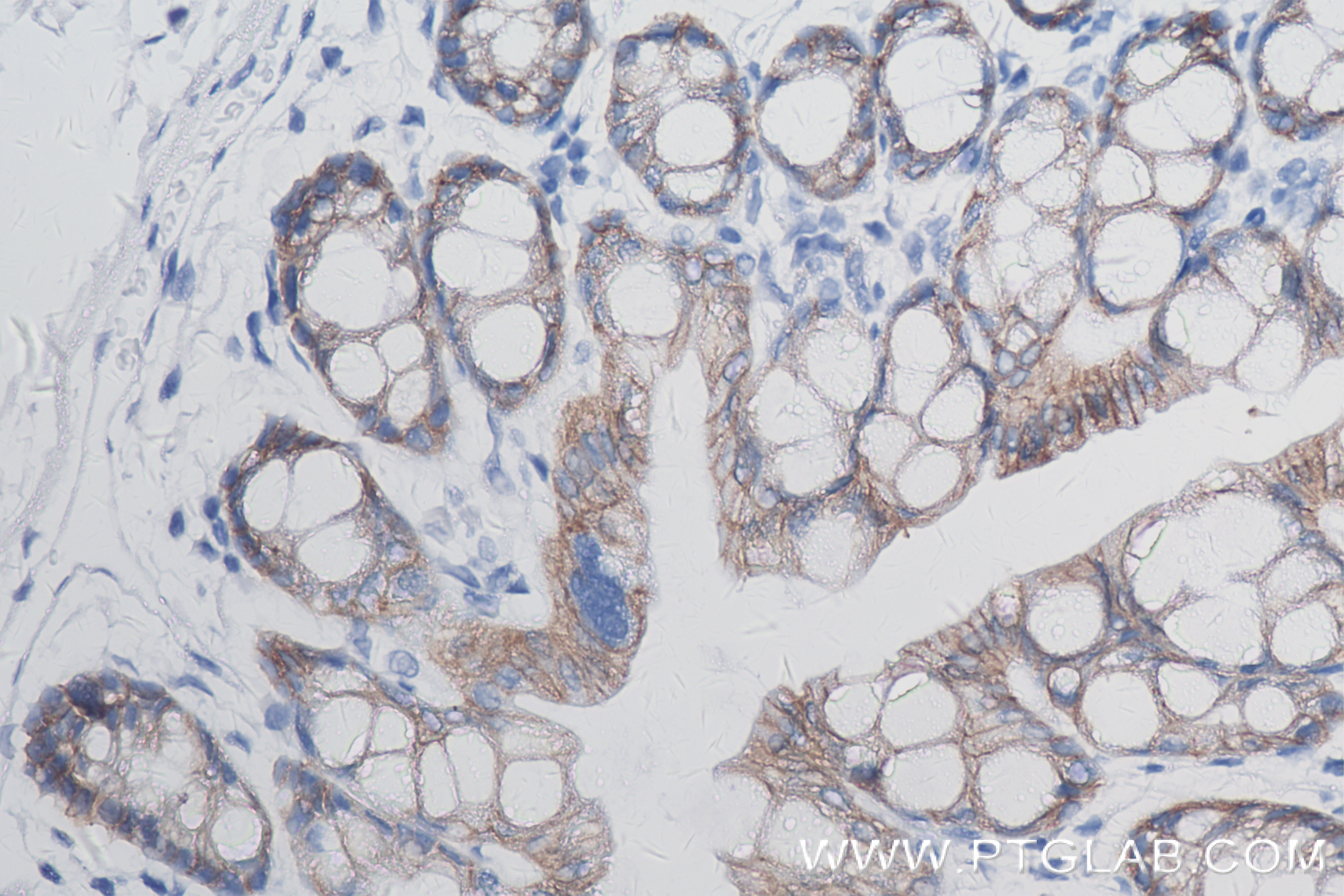 IHC staining of mouse colon using 84490-2-RR