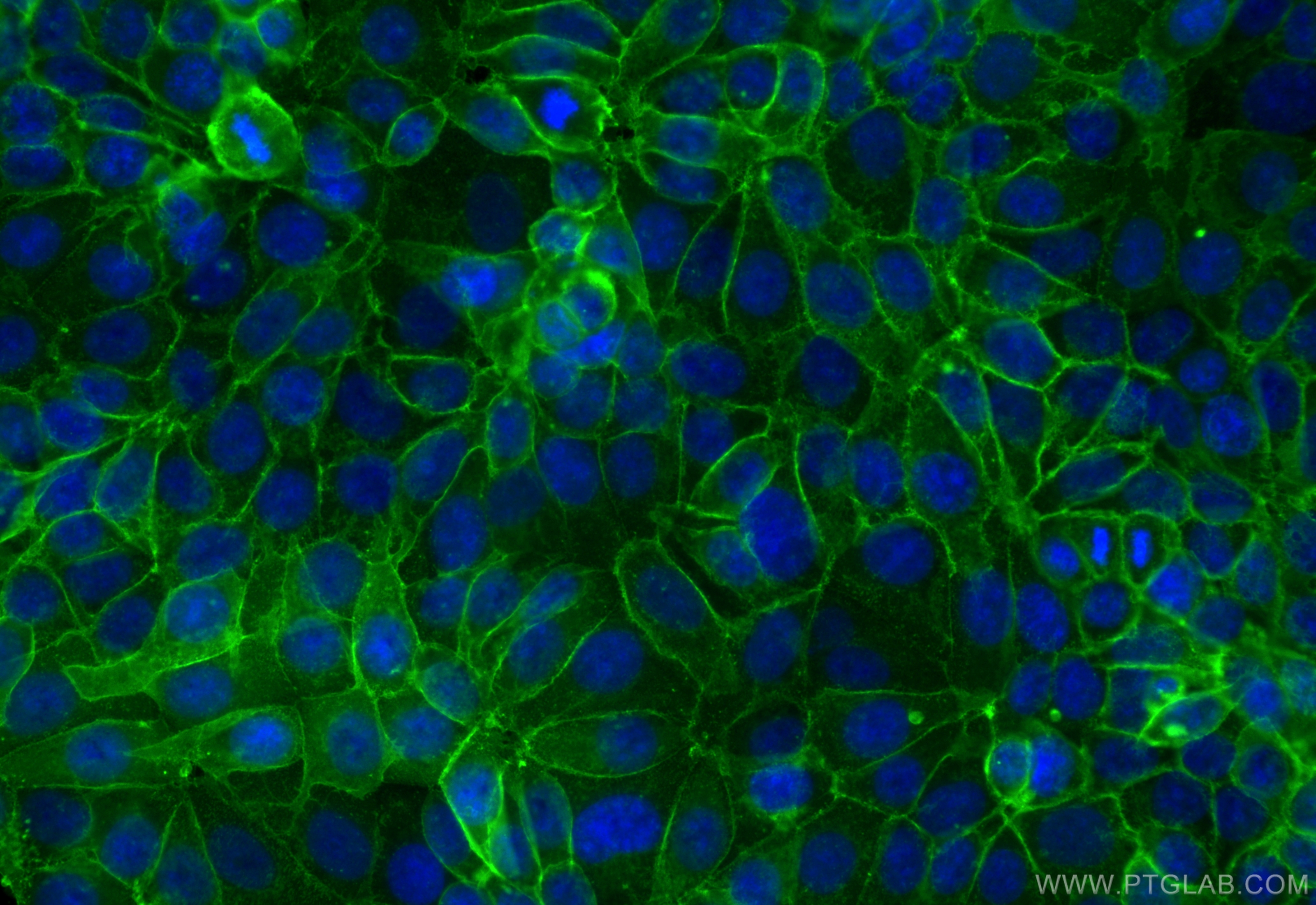 IF Staining of MCF-7 using CL488-84073-6