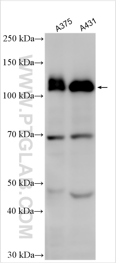 WB analysis using 25749-1-AP