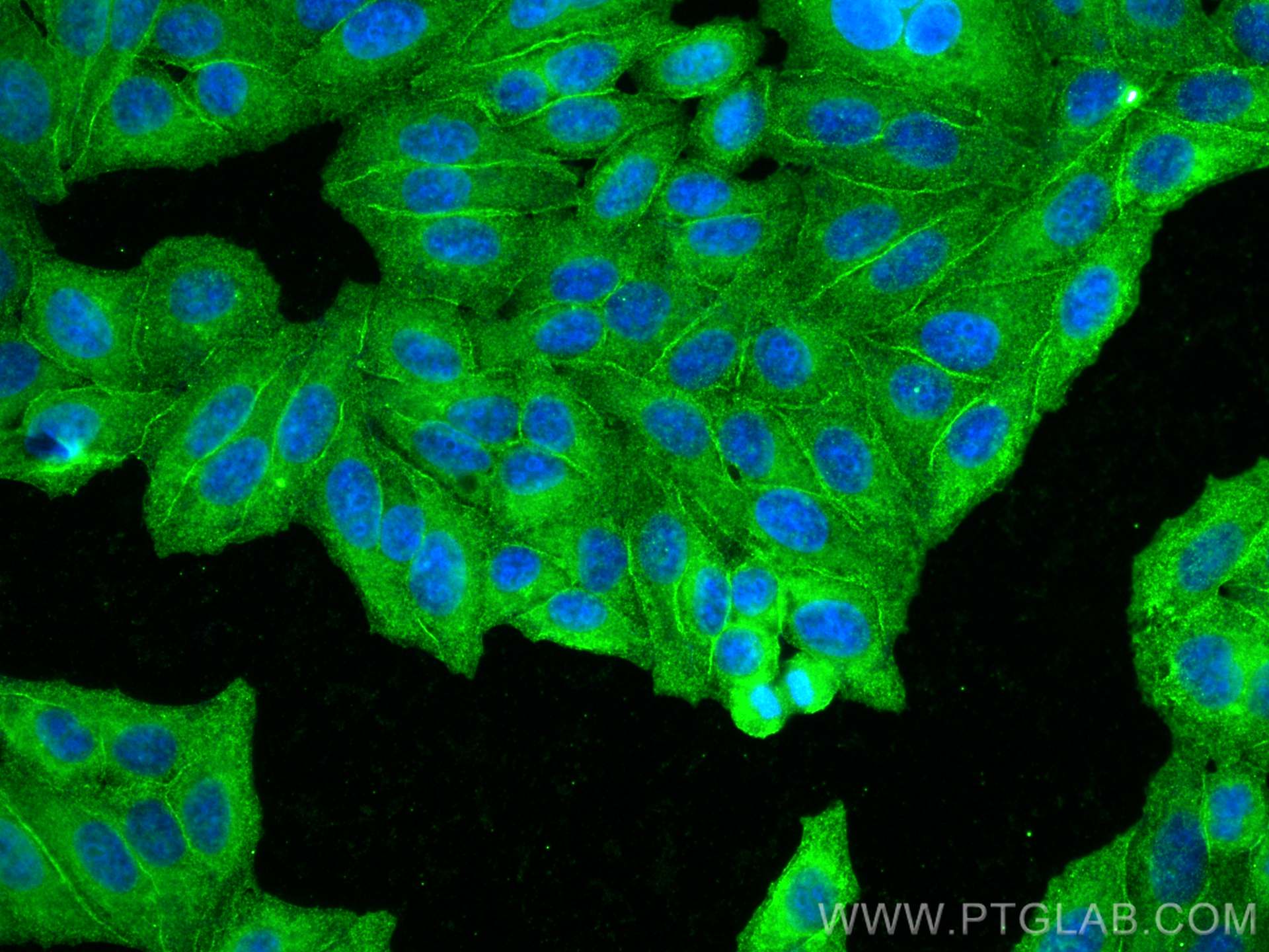 IF Staining of HepG2 using 66736-1-Ig