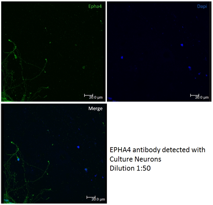 IF Staining of Neuron cells using 21875-1-AP (same clone as 21875-1-PBS)