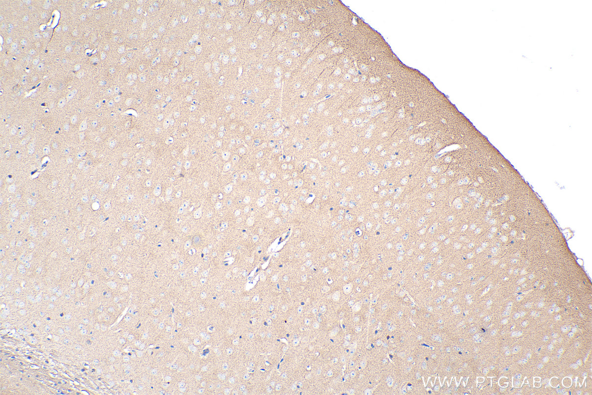 IHC staining of mouse brain using 21875-1-AP (same clone as 21875-1-PBS)