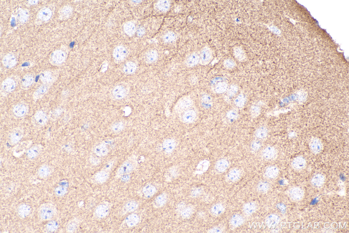 IHC staining of mouse brain using 21875-1-AP (same clone as 21875-1-PBS)