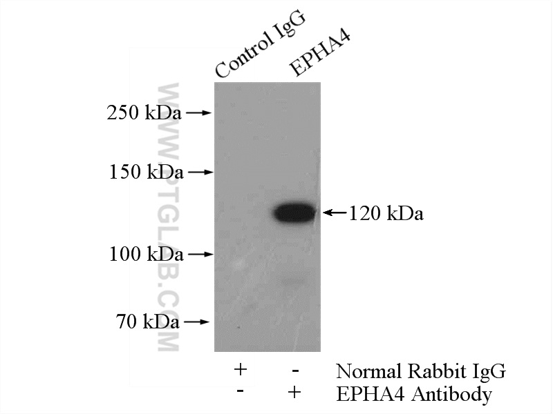 IP experiment of mouse brain using 21875-1-AP