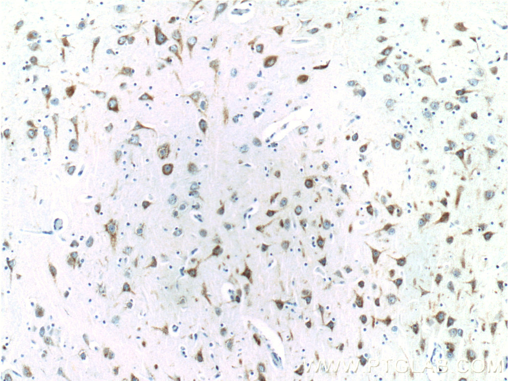 IHC staining of human brain using 24452-1-AP