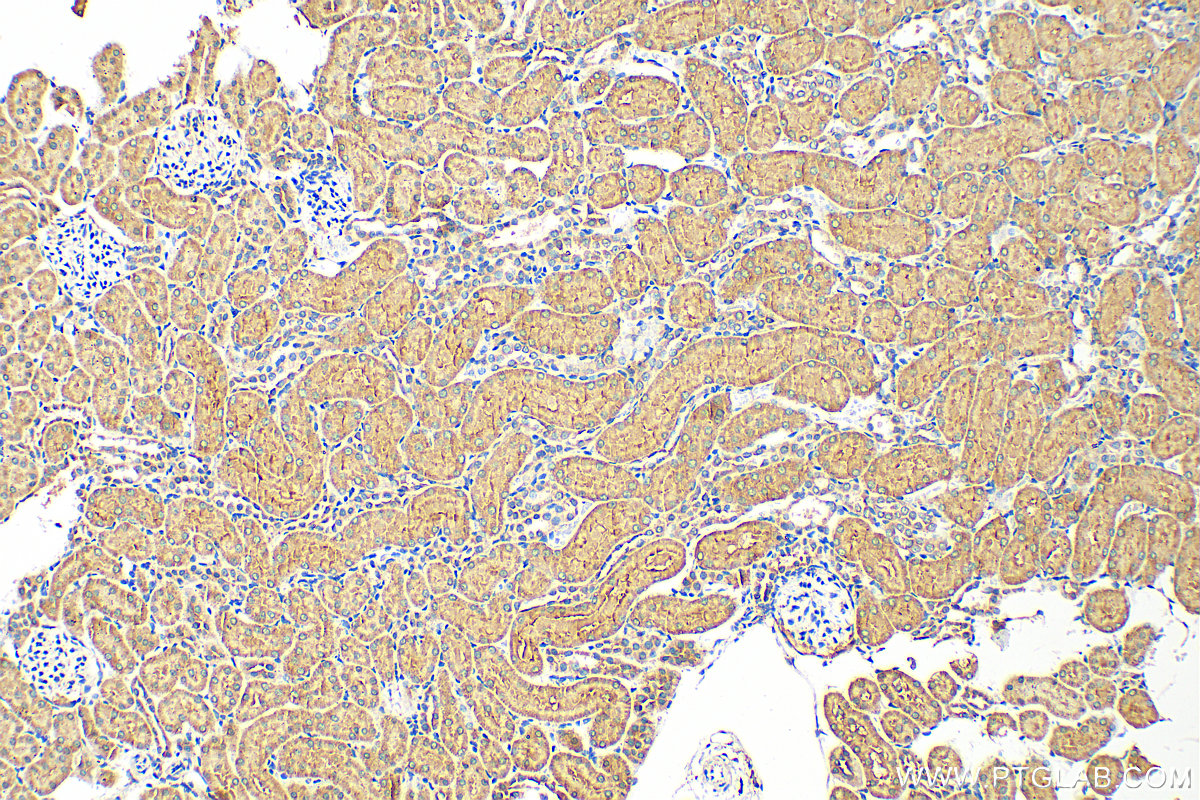 IHC staining of rat kidney using 10833-1-AP