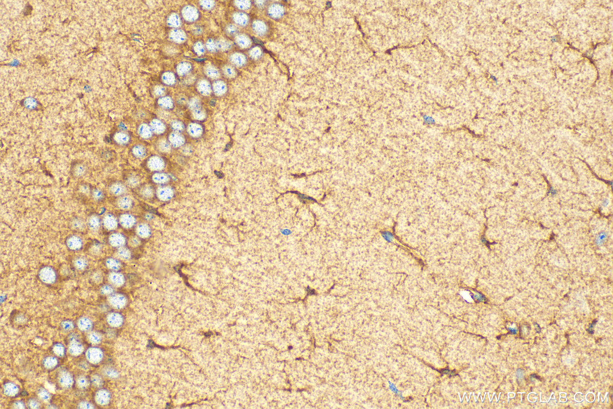 IHC staining of mouse brain using 10833-1-AP