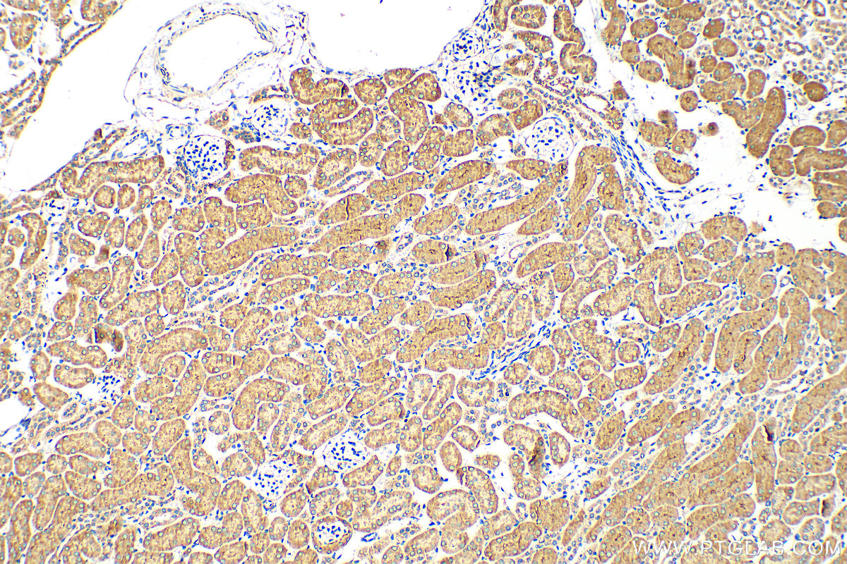 IHC staining of mouse kidney using 10833-1-AP