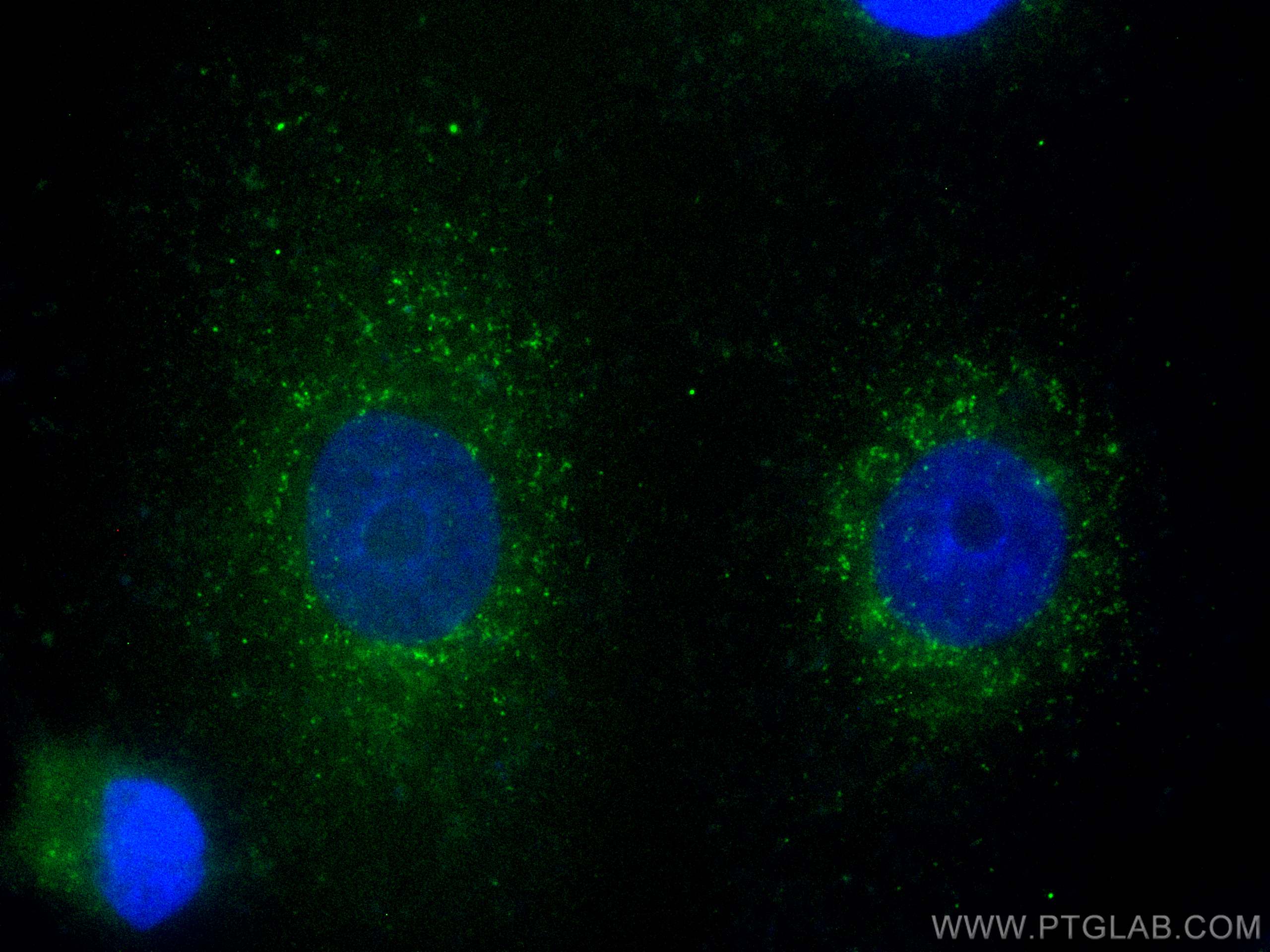 IF Staining of A549 using FITC-67322