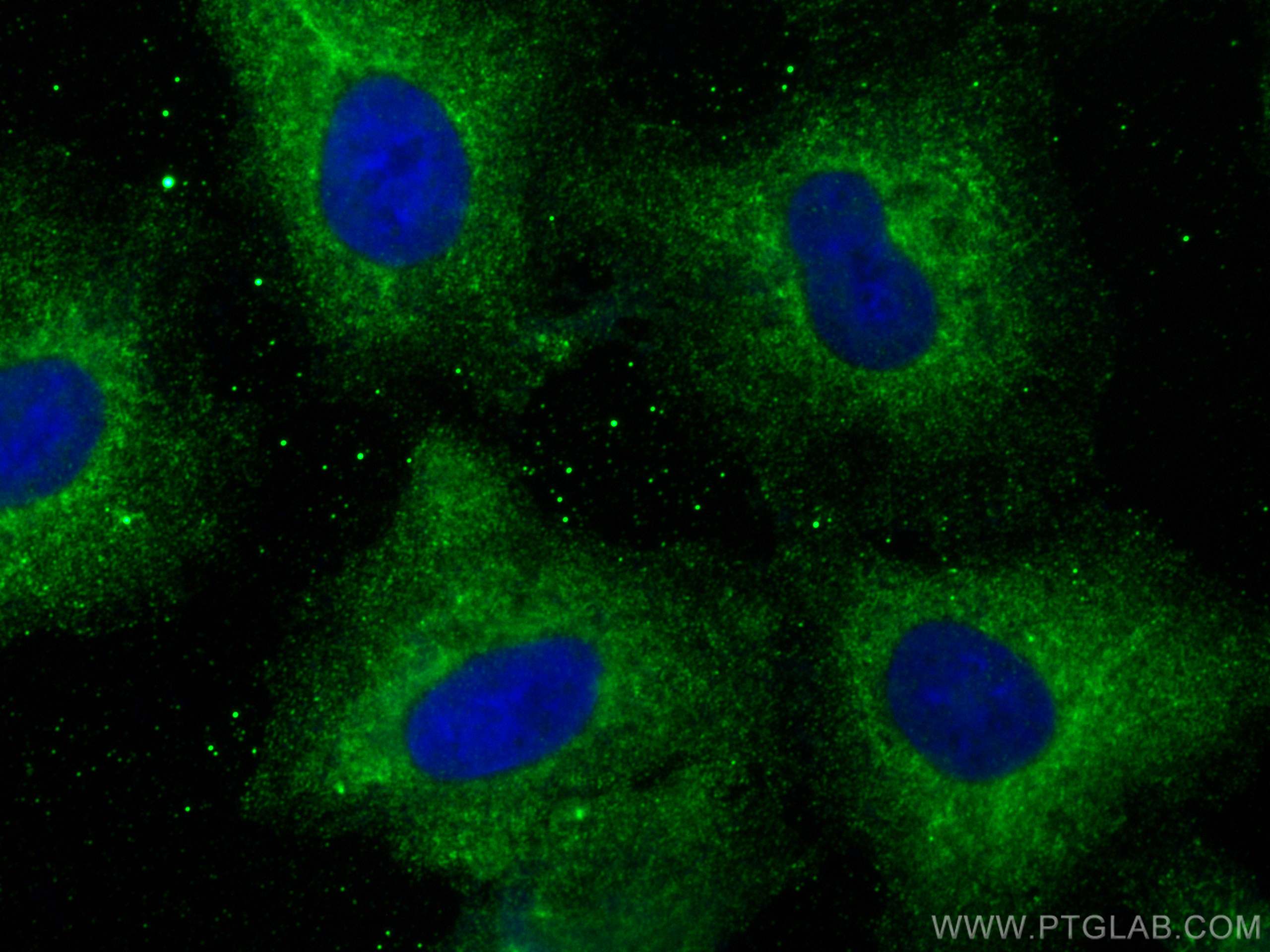 IF Staining of A549 using 25608-1-AP