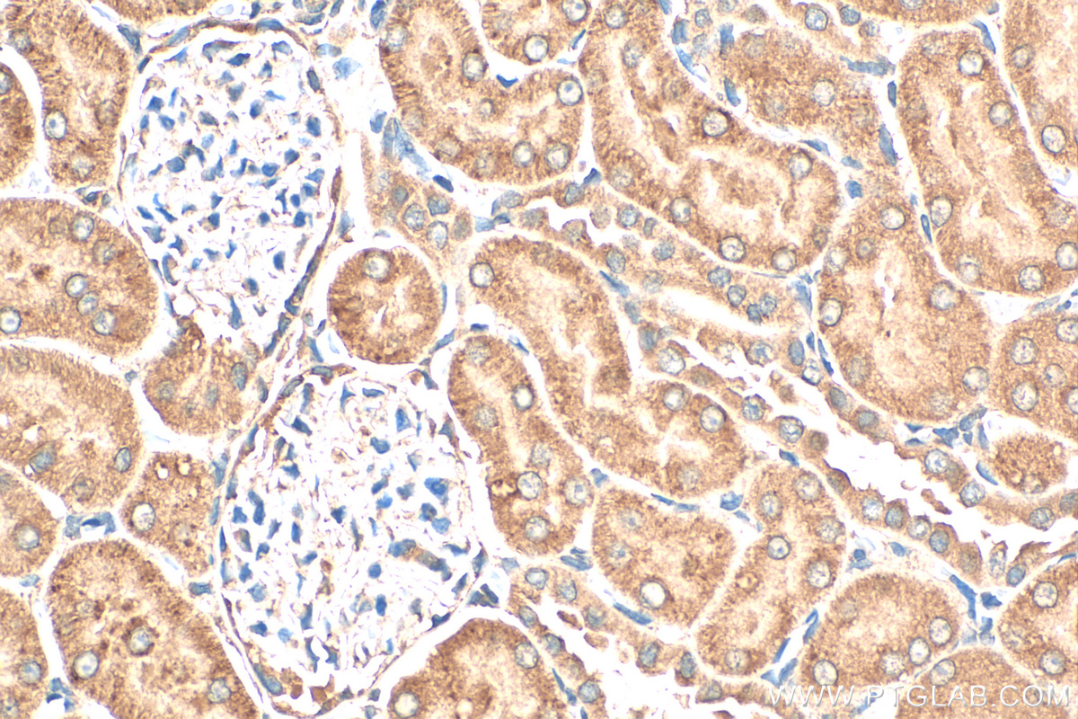 IHC staining of rat kidney using 17908-1-AP