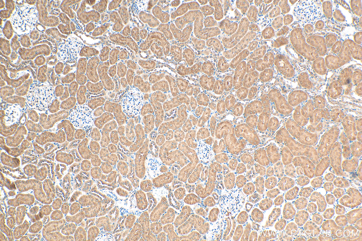 IHC staining of rat kidney using 17908-1-AP