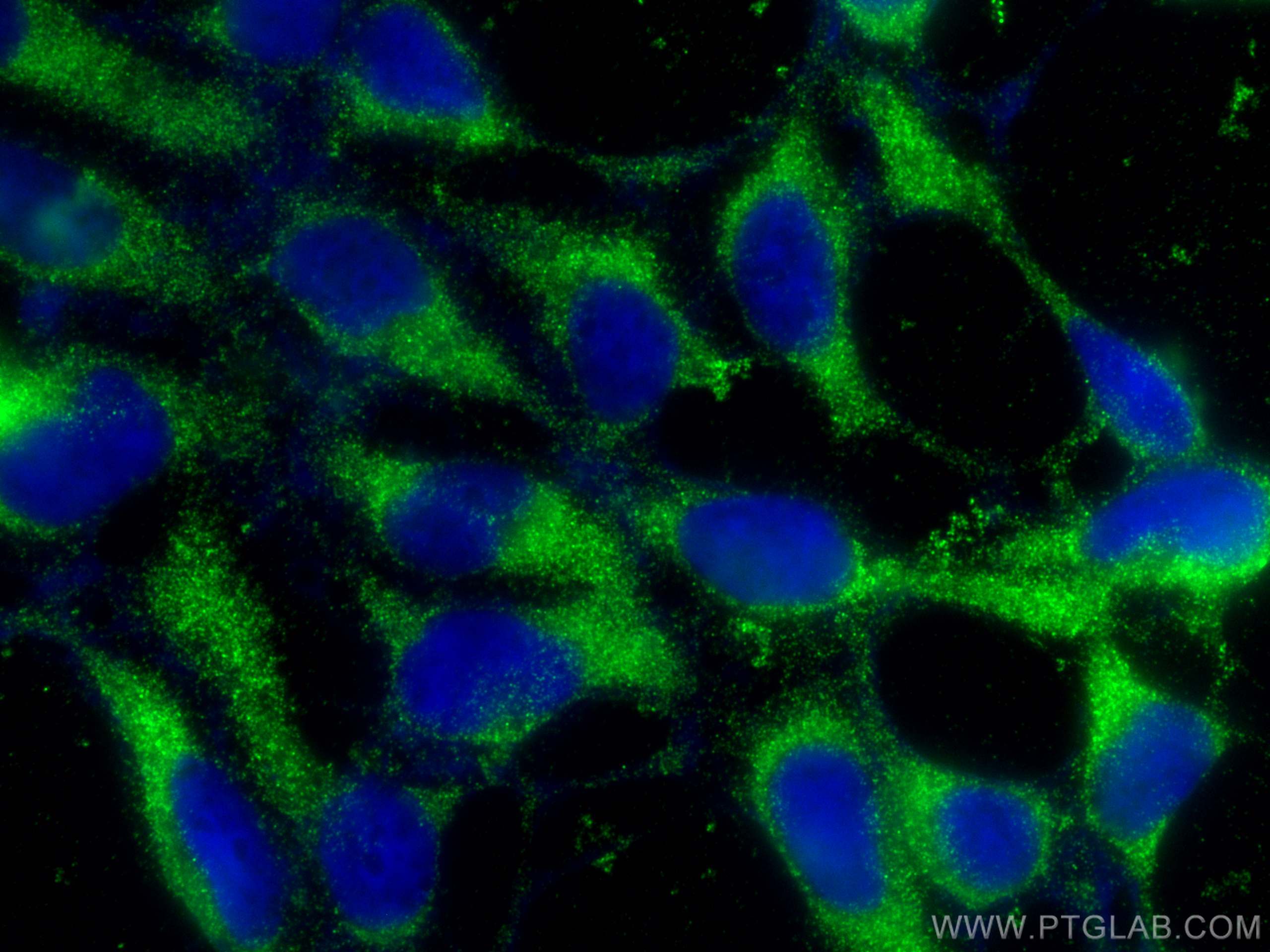 IF Staining of HEK-293 using 25307-1-AP