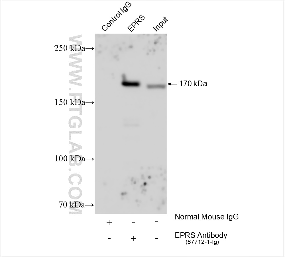 IP experiment of HeLa using 67712-1-Ig