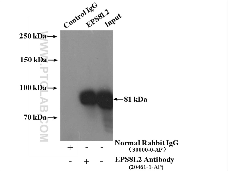 IP experiment of HeLa using 20461-1-AP