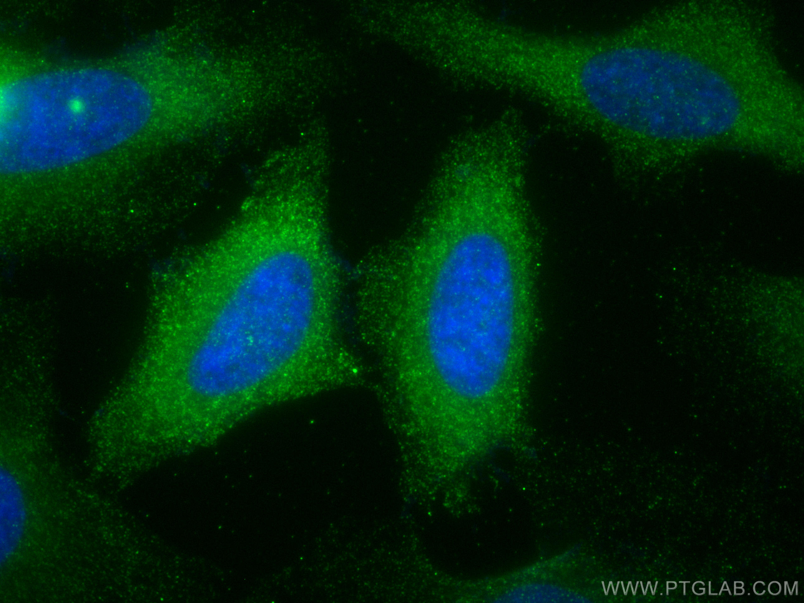 IF Staining of HeLa using 68330-1-Ig (same clone as 68330-1-PBS)