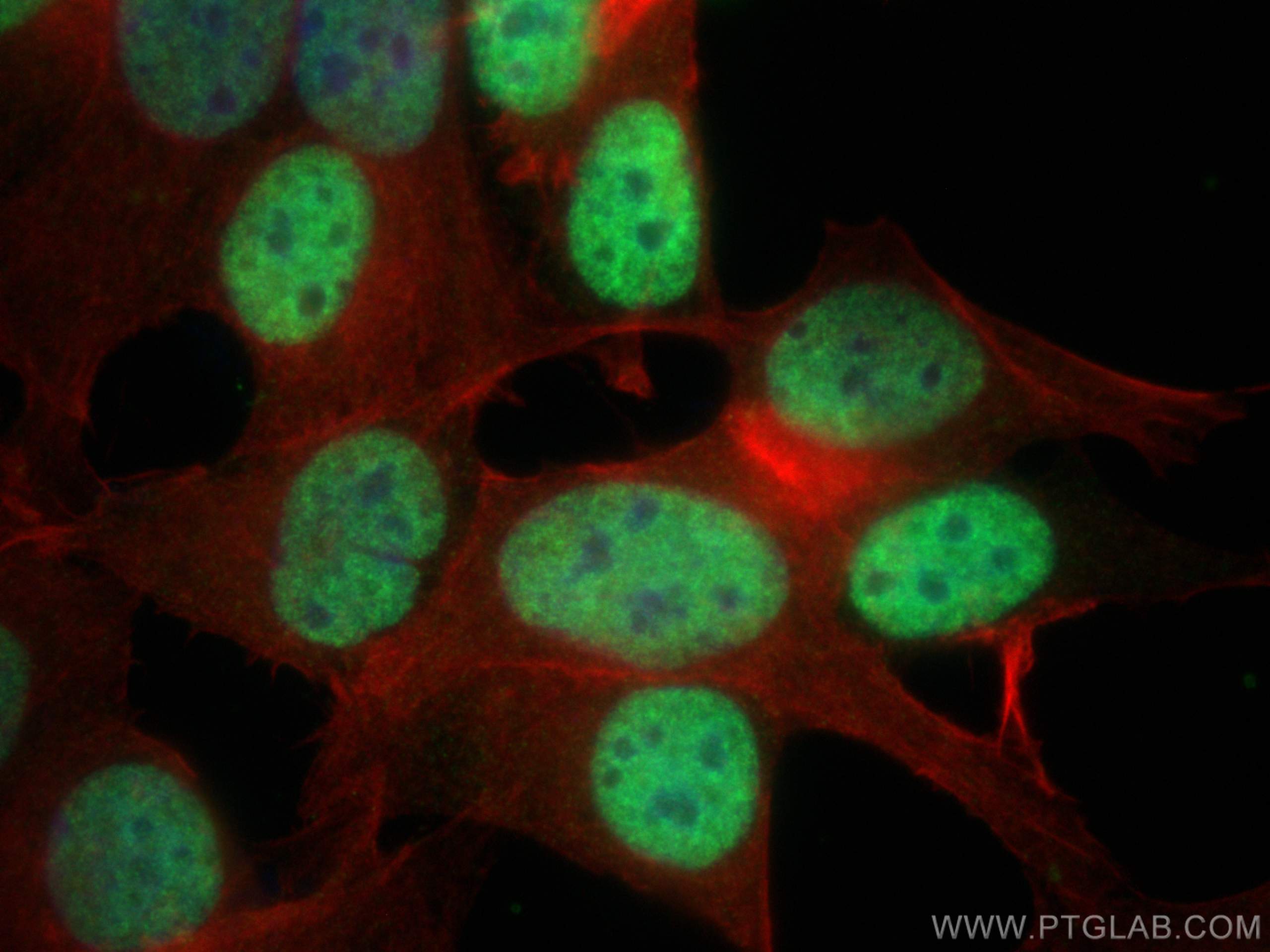 IF Staining of MCF-7 using 20698-1-AP