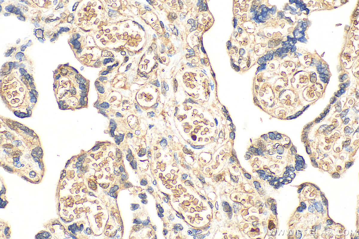 IHC staining of human placenta using 13643-1-AP