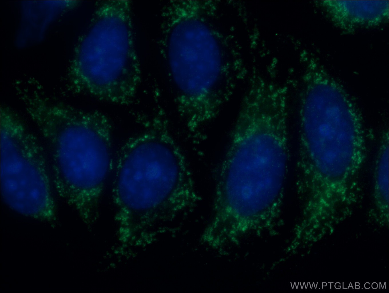 IF Staining of HepG2 using 14637-1-AP