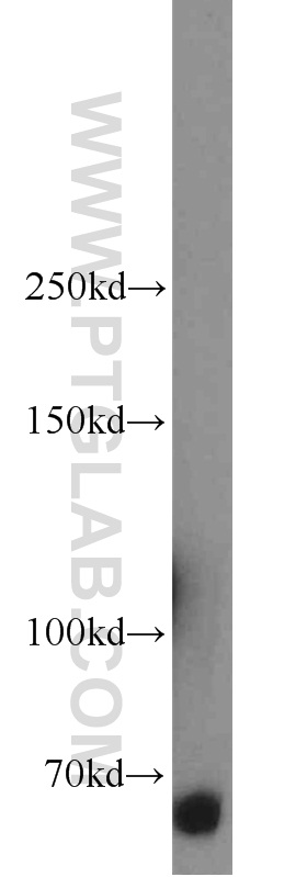 WB analysis of K-562 using 14637-1-AP