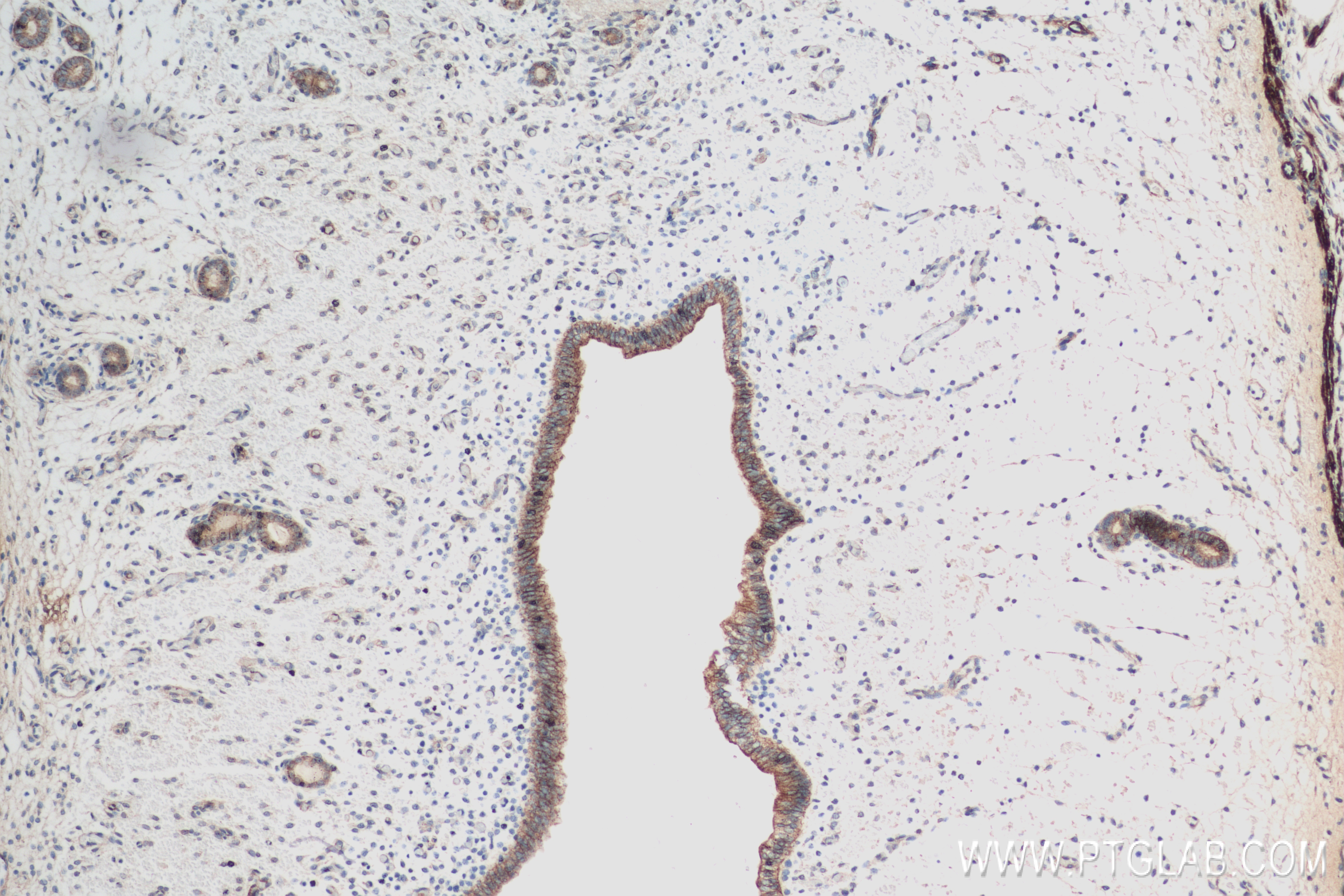 IHC staining of mouse uterus using 84046-1-RR (same clone as 84046-1-PBS)