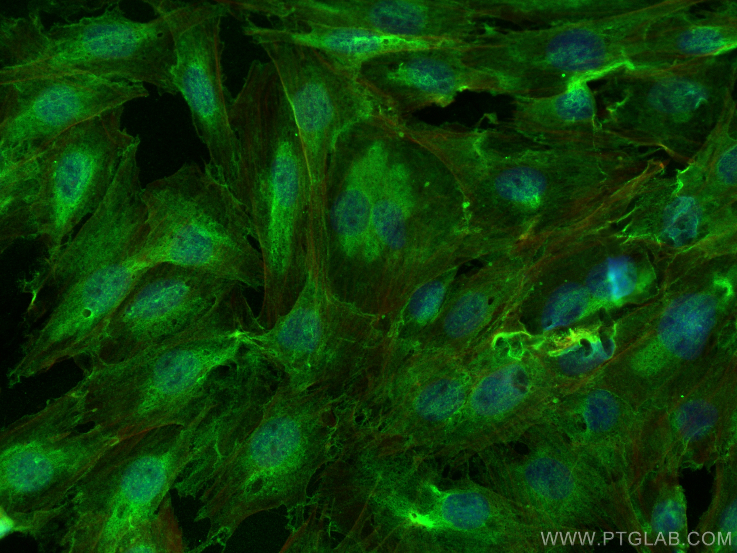 IF Staining of H9C2 using 22438-1-AP