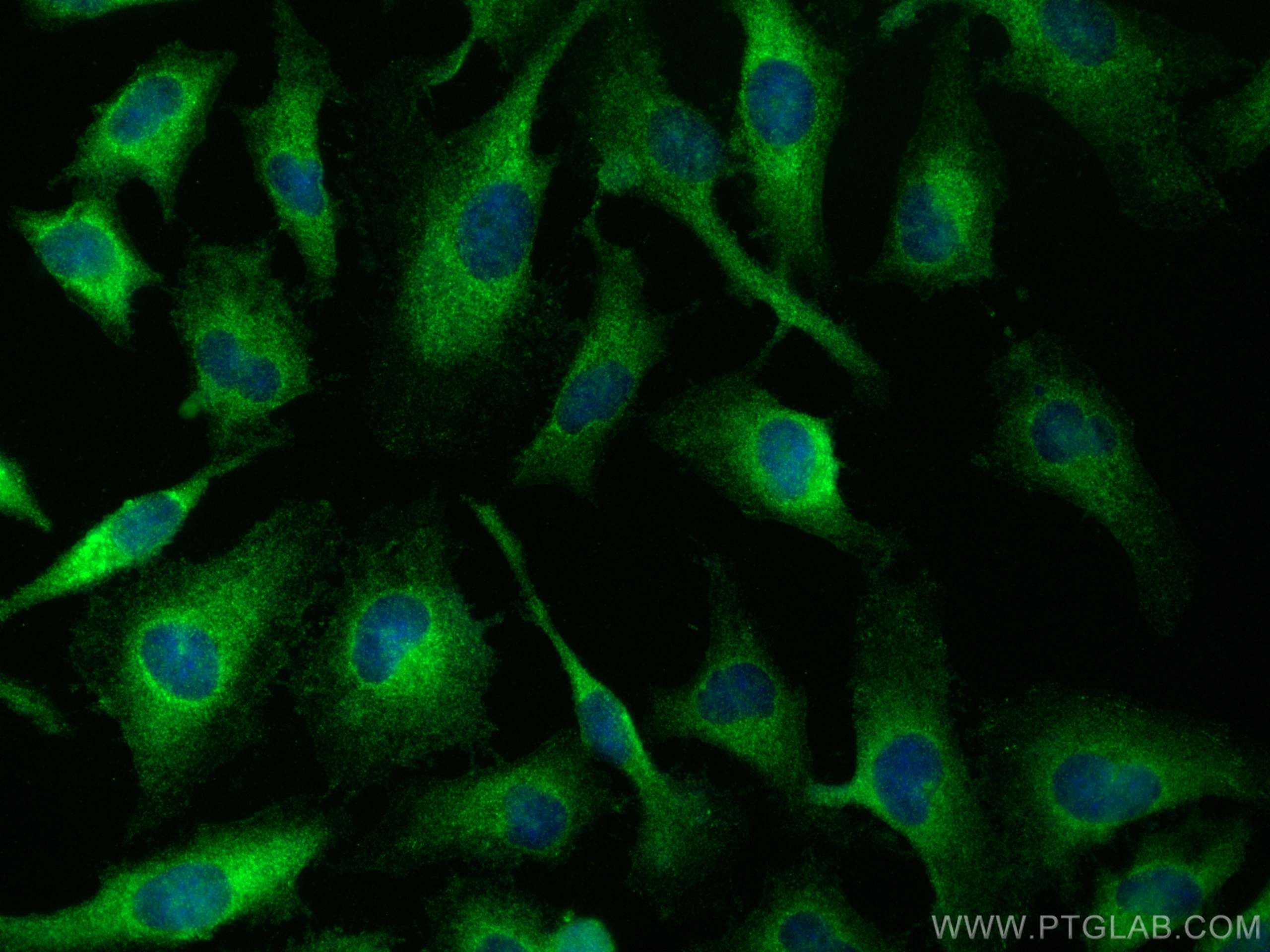 IF Staining of HeLa using 21396-1-AP