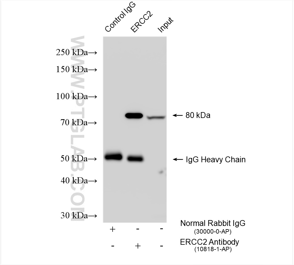 IP experiment of HEK-293 using 10818-1-AP