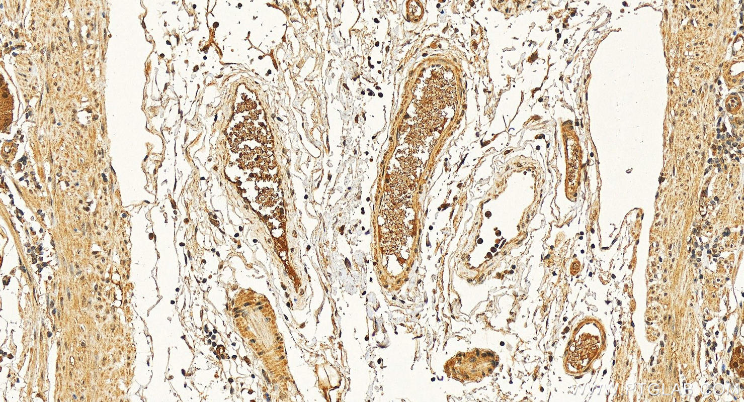 IHC staining of human stomach using 10580-1-AP