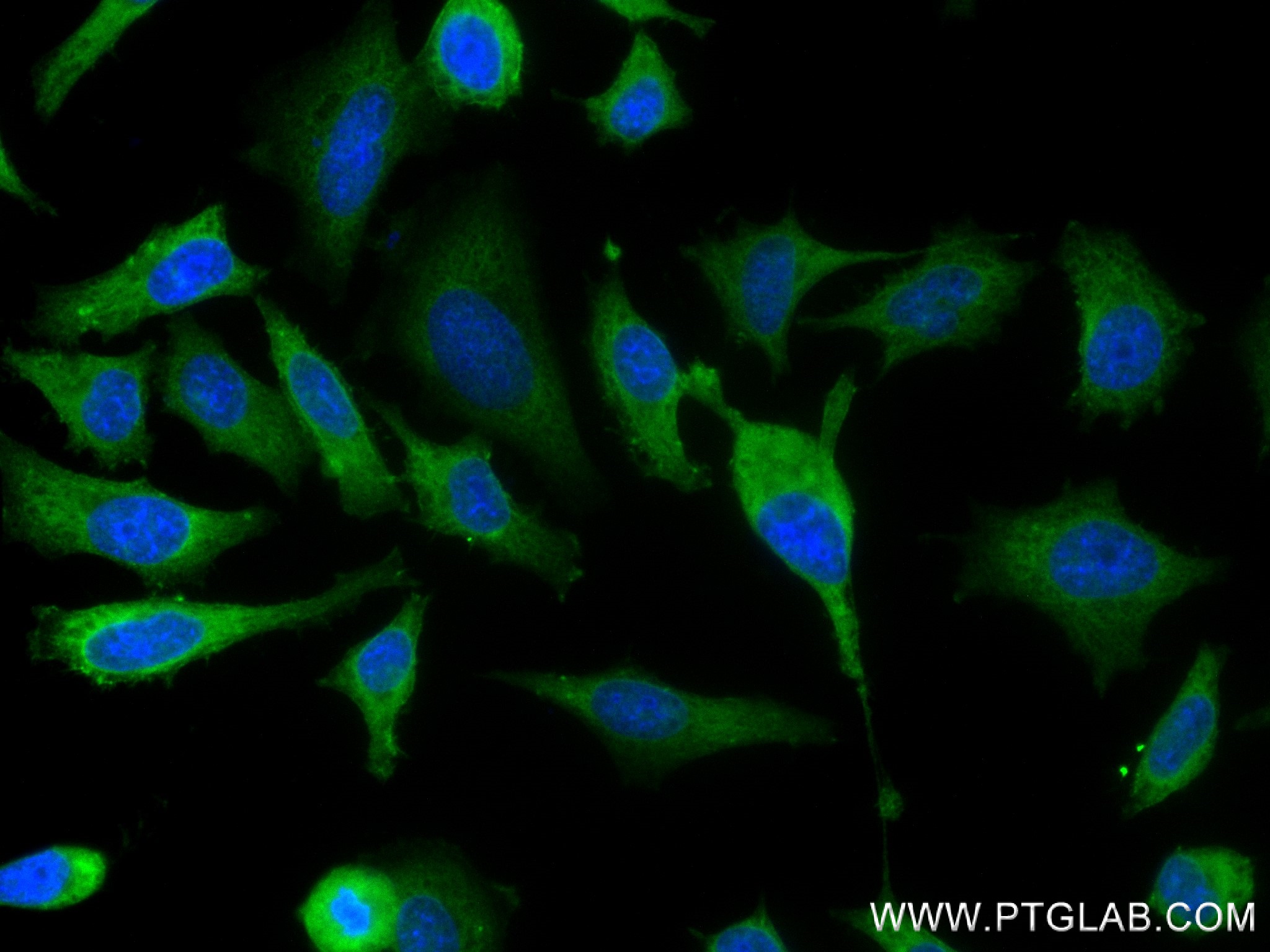 IF Staining of HeLa using 83533-1-RR (same clone as 83533-1-PBS)