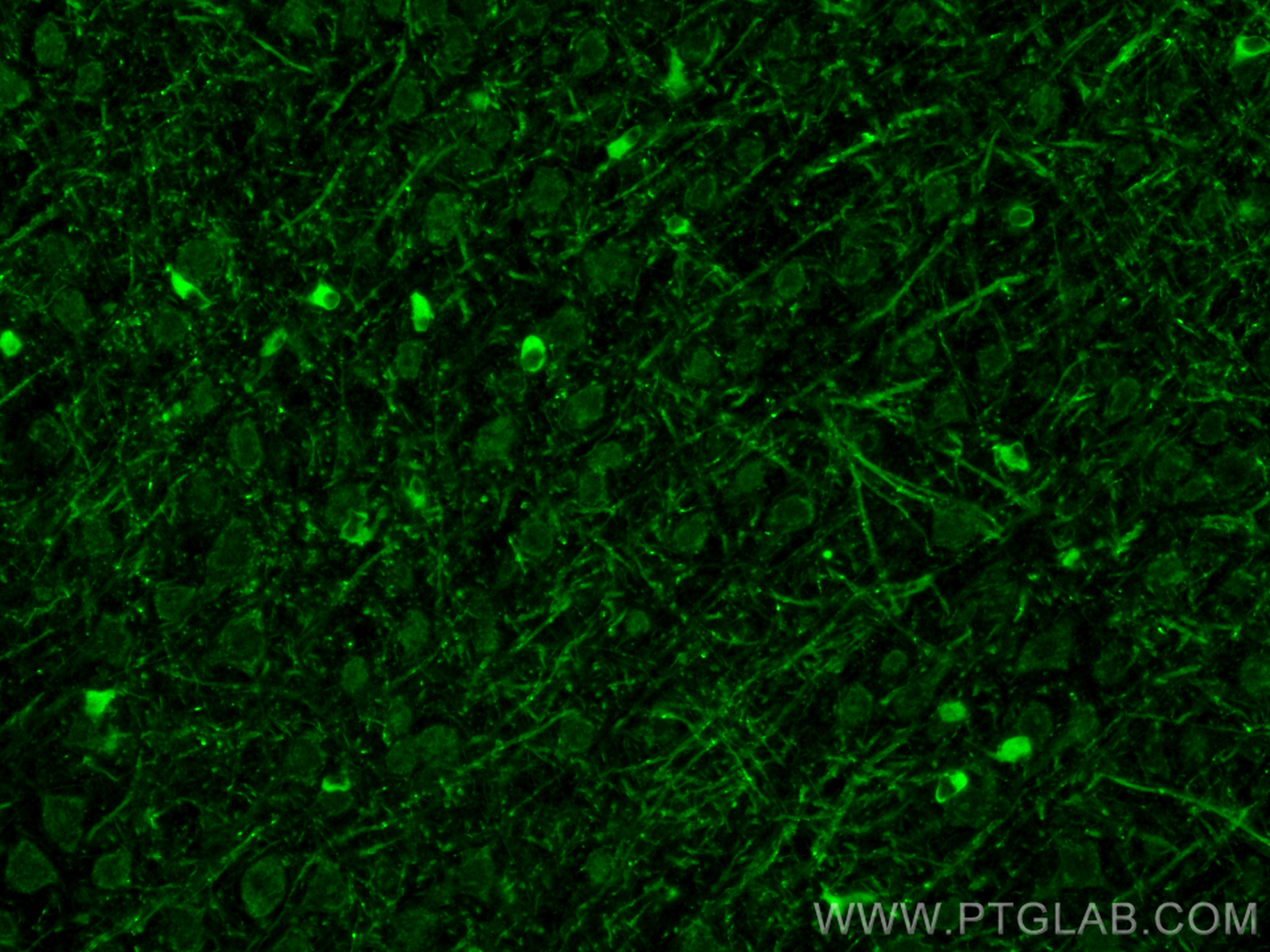 IF Staining of mouse brain using 31432-1-AP