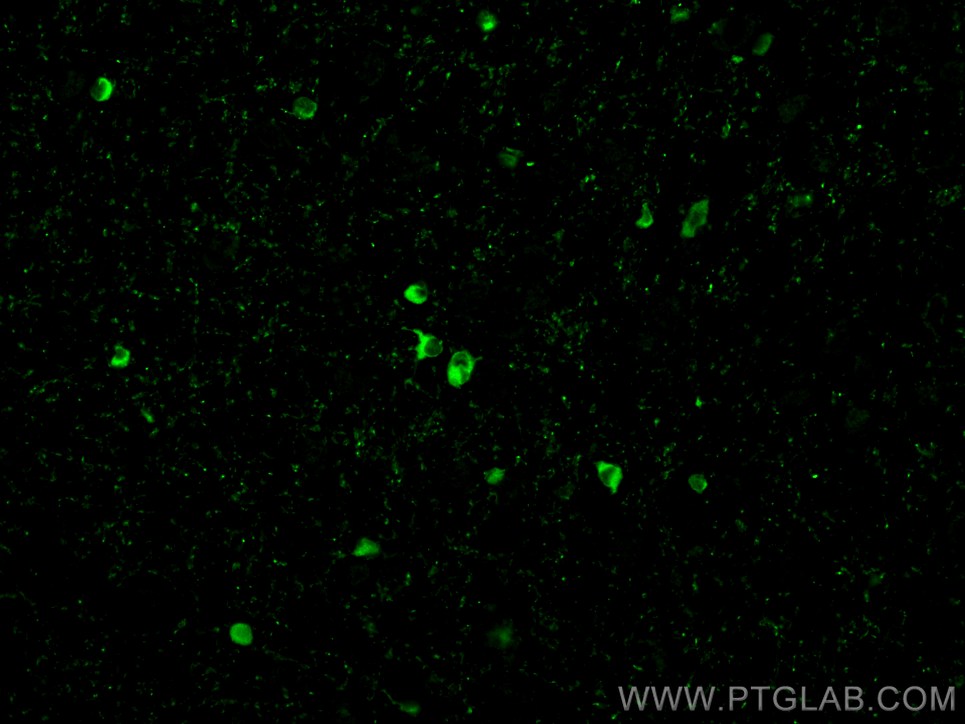 IF Staining of rat brain using 31432-1-AP