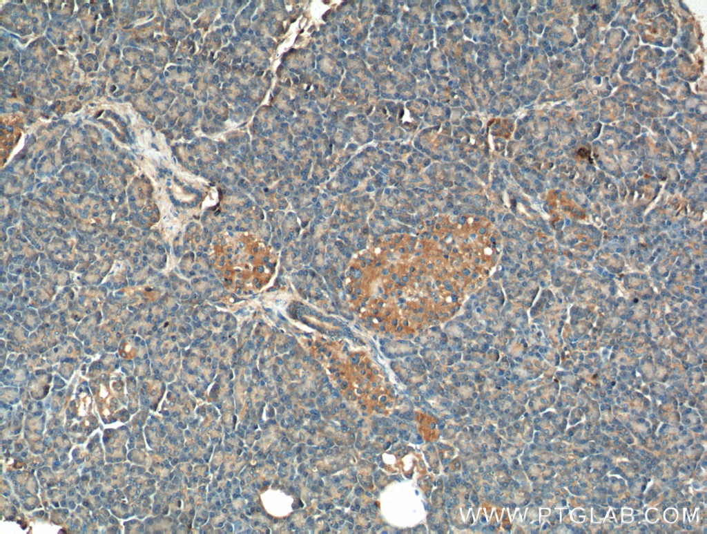 IHC staining of human pancreas using 18312-1-AP