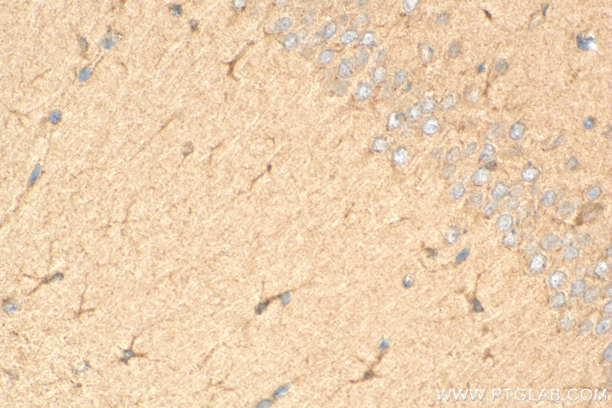 IHC staining of mouse brain using 16016-1-AP