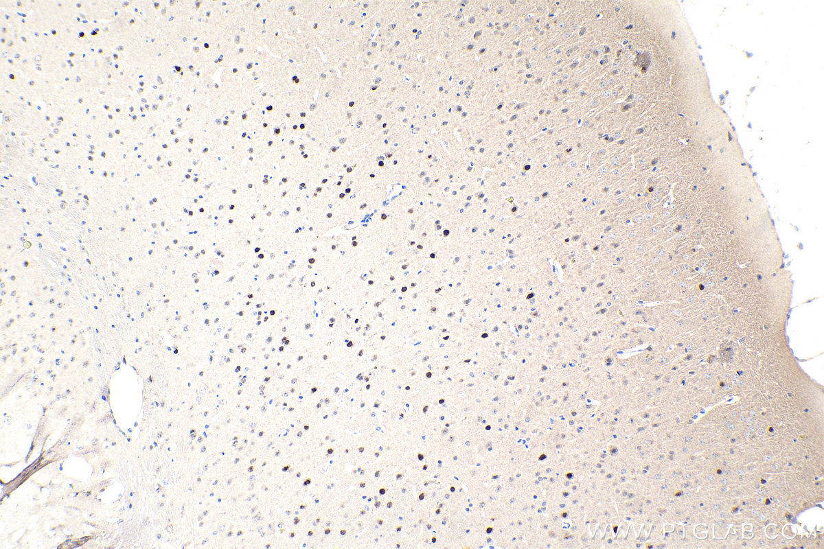 IHC staining of mouse brain using 14017-1-AP