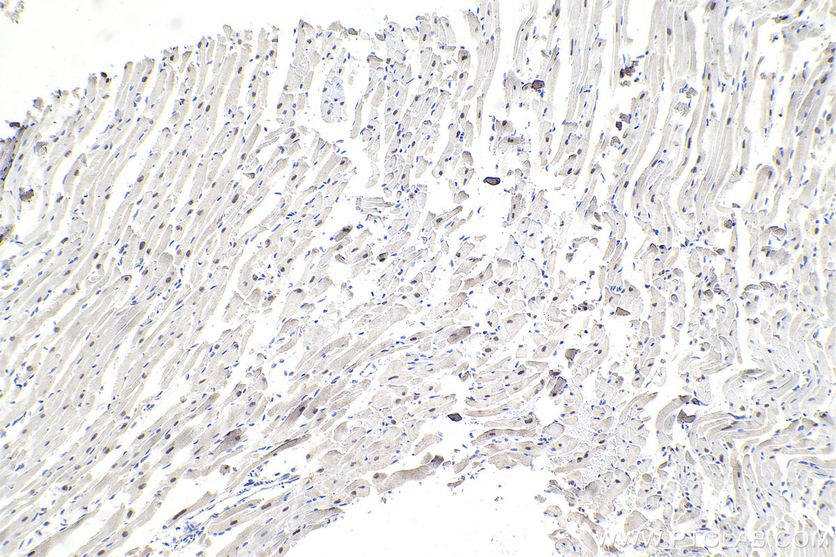 IHC staining of mouse heart using 14017-1-AP