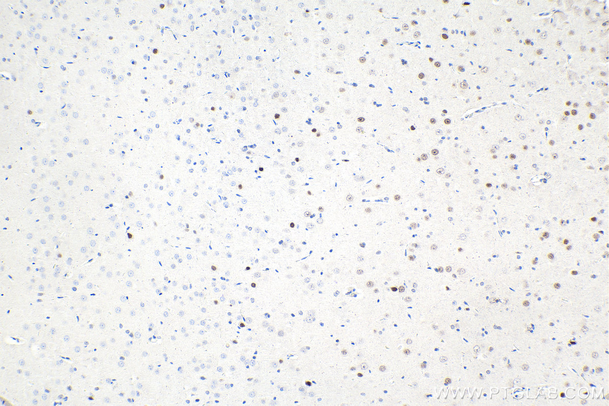 IHC staining of rat brain using 14017-1-AP