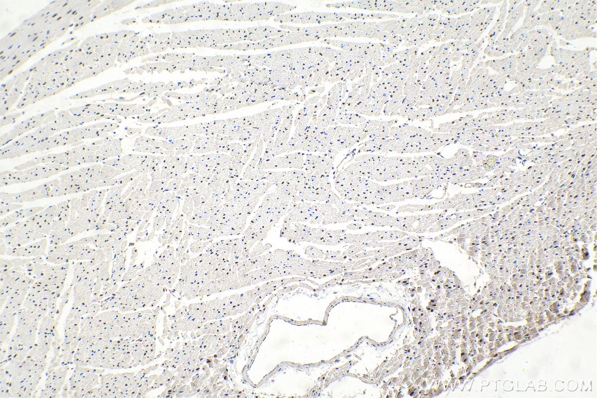 IHC staining of rat heart using 14017-1-AP