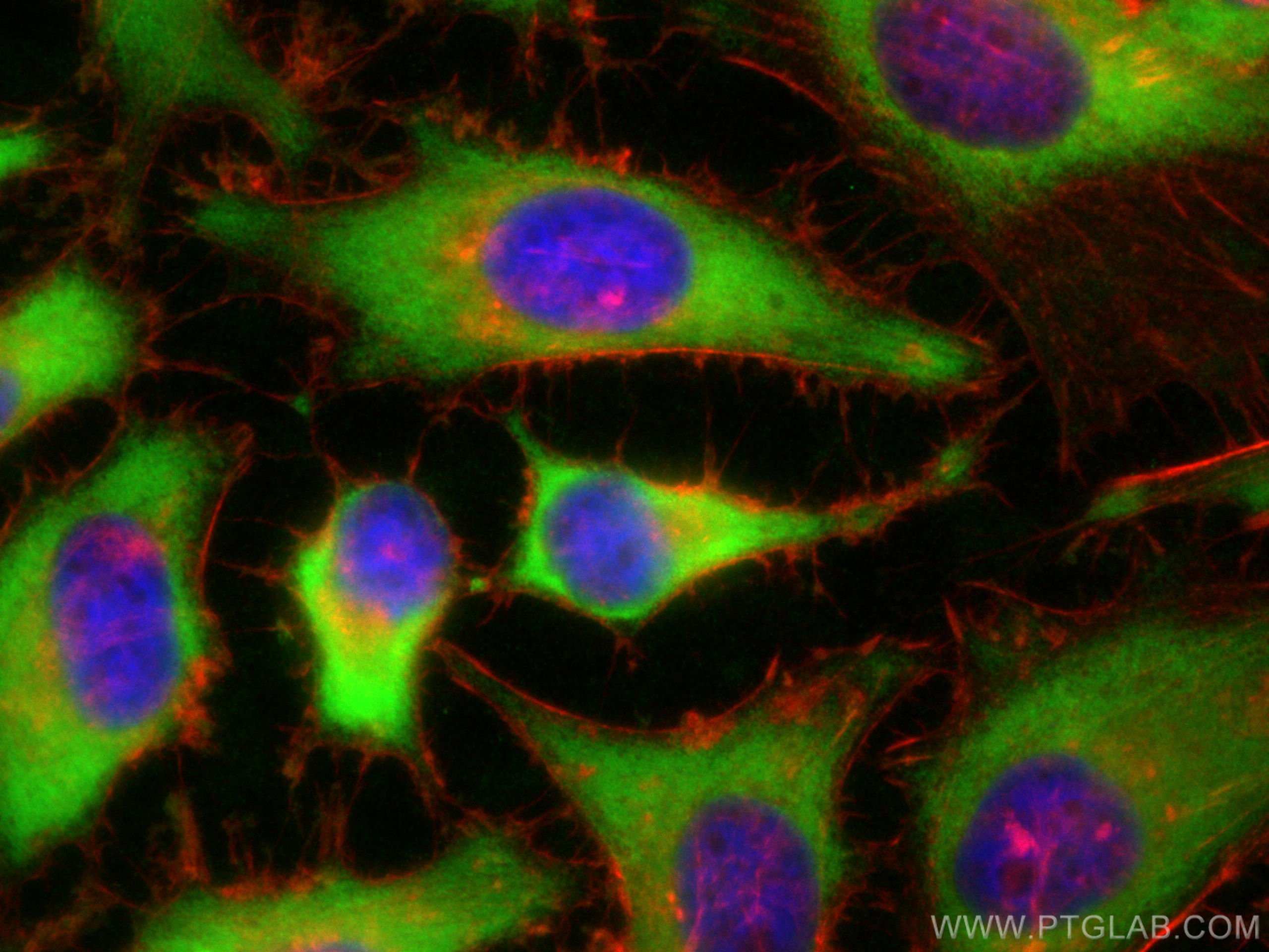 IF Staining of HeLa using 10884-1-AP