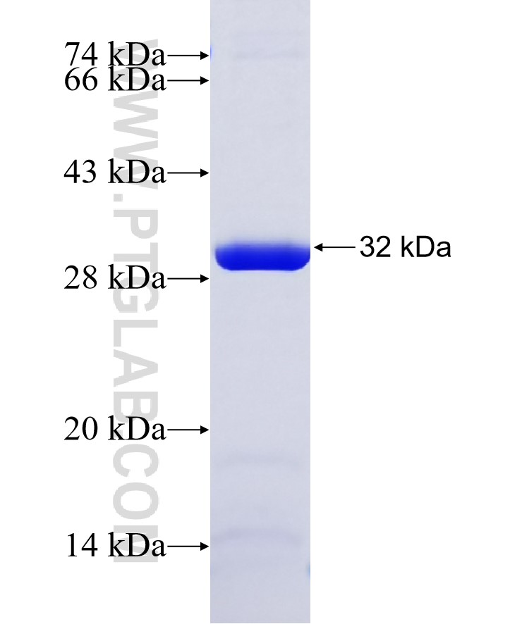 ETFB fusion protein Ag12526 SDS-PAGE