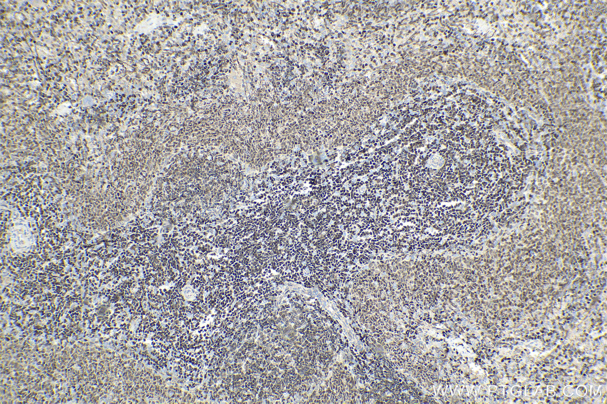 IHC staining of rat spleen using 66598-1-Ig