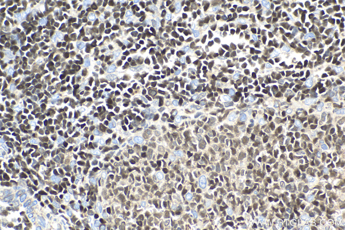 IHC staining of rat spleen using 66598-1-Ig (same clone as 66598-1-PBS)