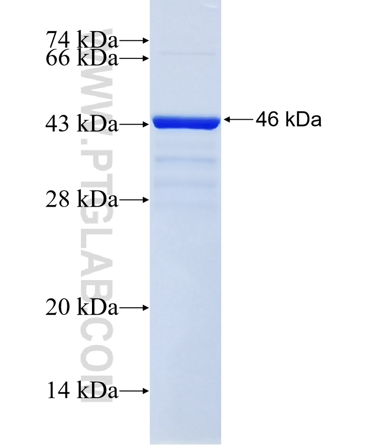 ETV1 fusion protein Ag28158 SDS-PAGE