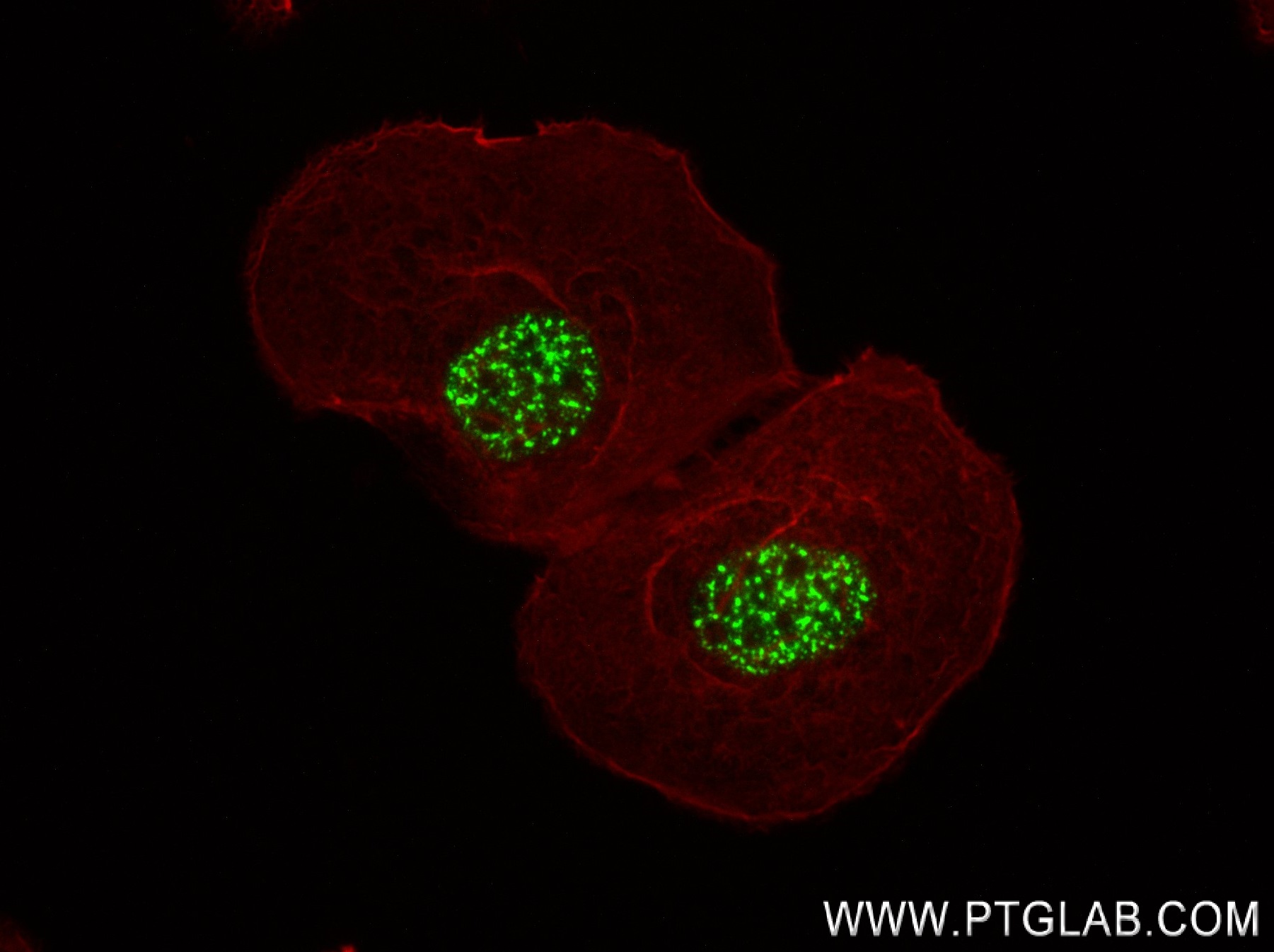 IF Staining of A431 using 83891-6-RR