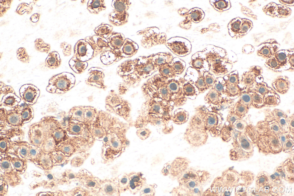 IHC staining of human placenta using 55367-1-AP